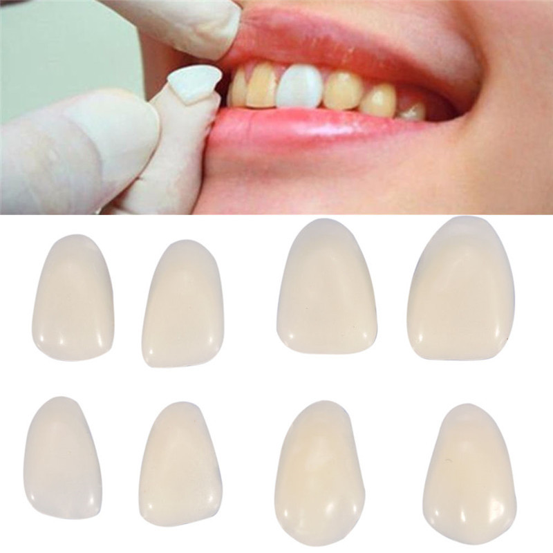 Teeth Whitening Veneers - Стоматологические вставные зубы Временные коронки для