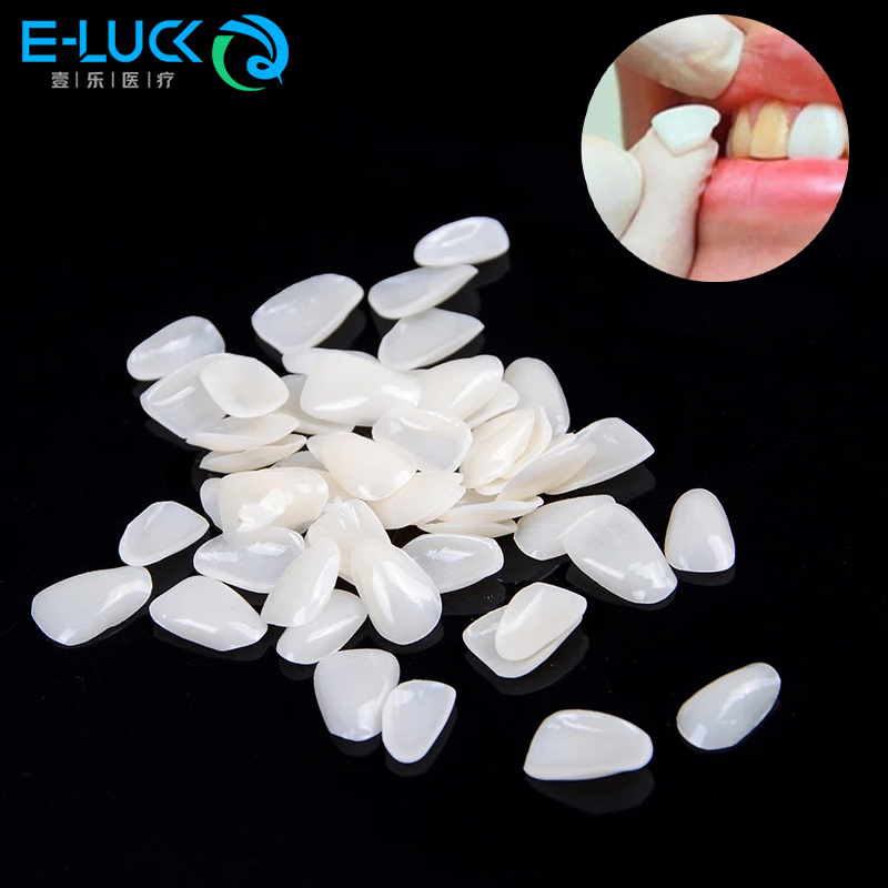 Teeth Whitening Veneers - 50 шт., виниры для зубов, временная