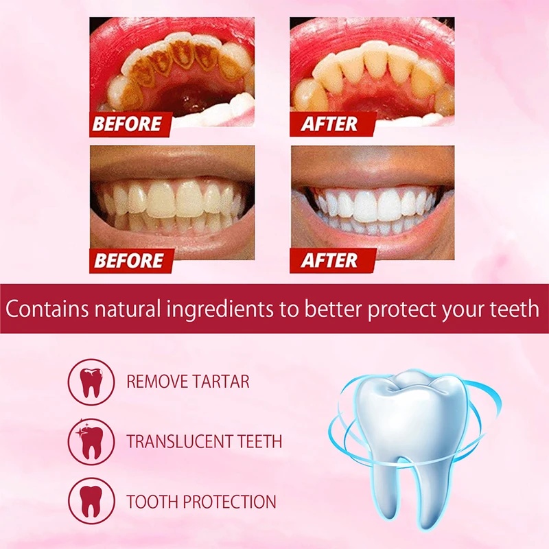 SP-4 Пробиотическая отбеливающ – обзор и цена Teeth Whitening Enzymes