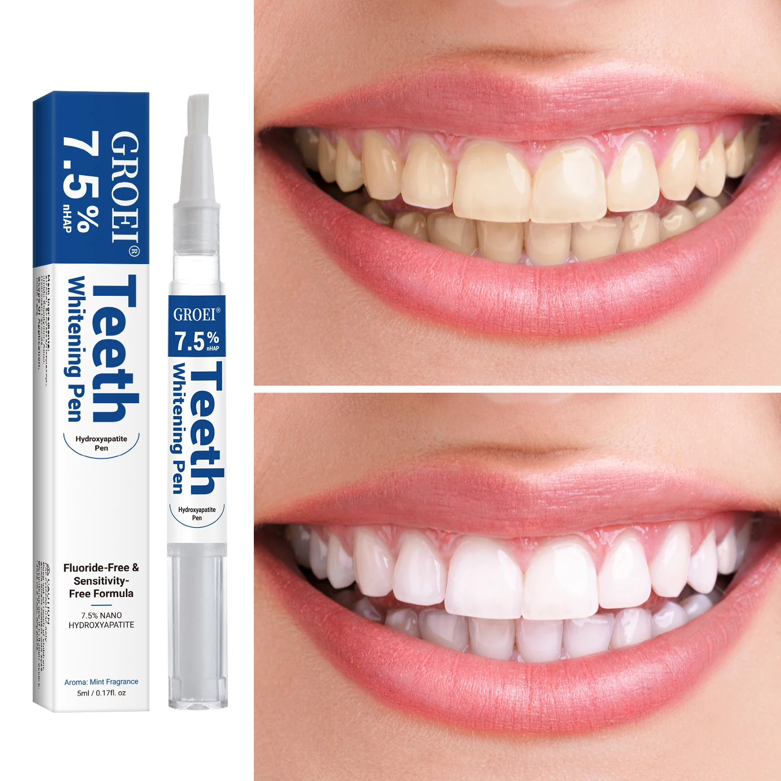 Гидроксипатитовая ручка для от – обзор и цена Teeth Whitening Groupon