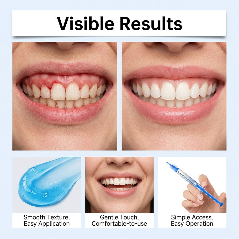 3 шт. геля для восстановления  – обзор и цена Teeth Whitening Gum