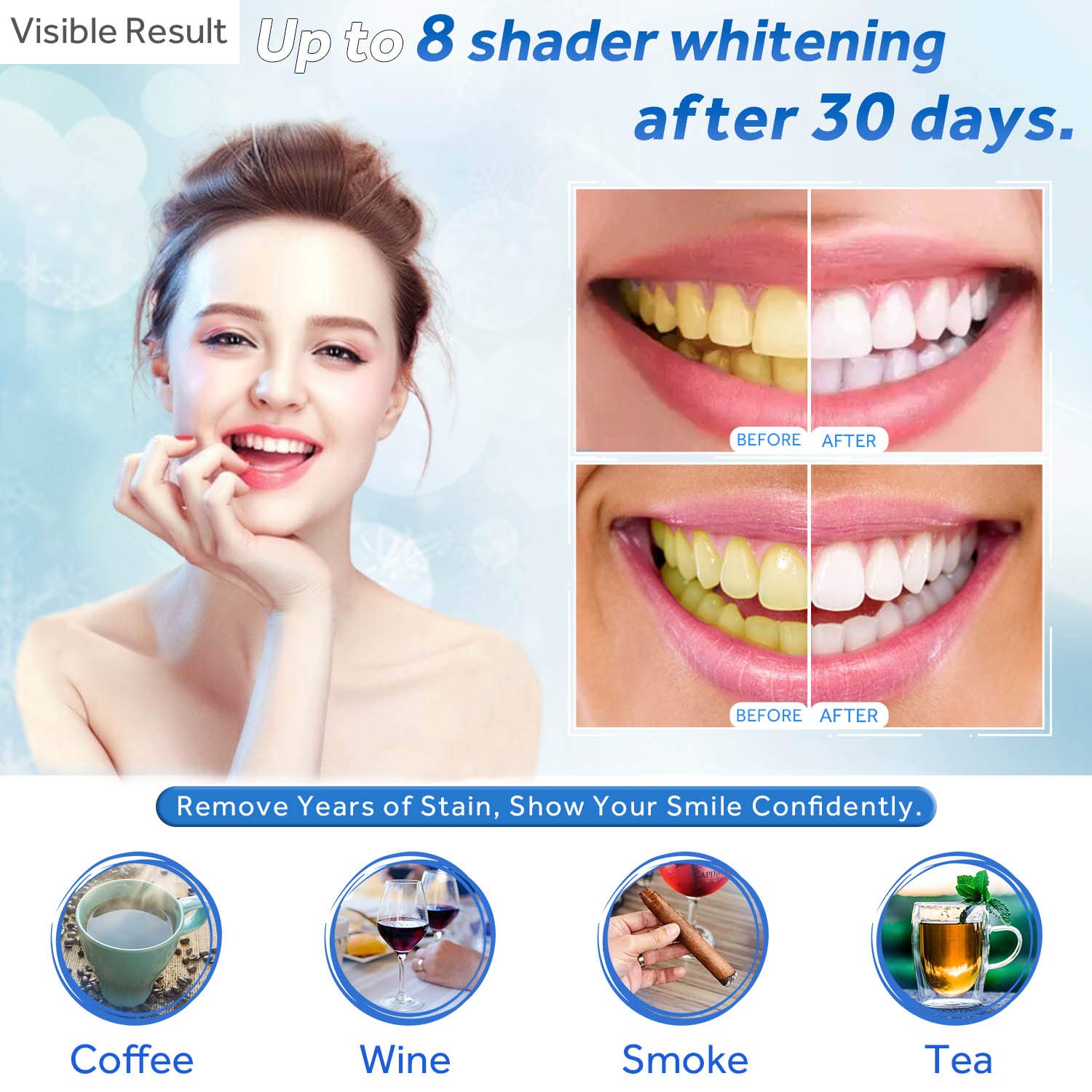 Гель для отбеливания зубов, шп – обзор и цена Teeth Whitening Groupon