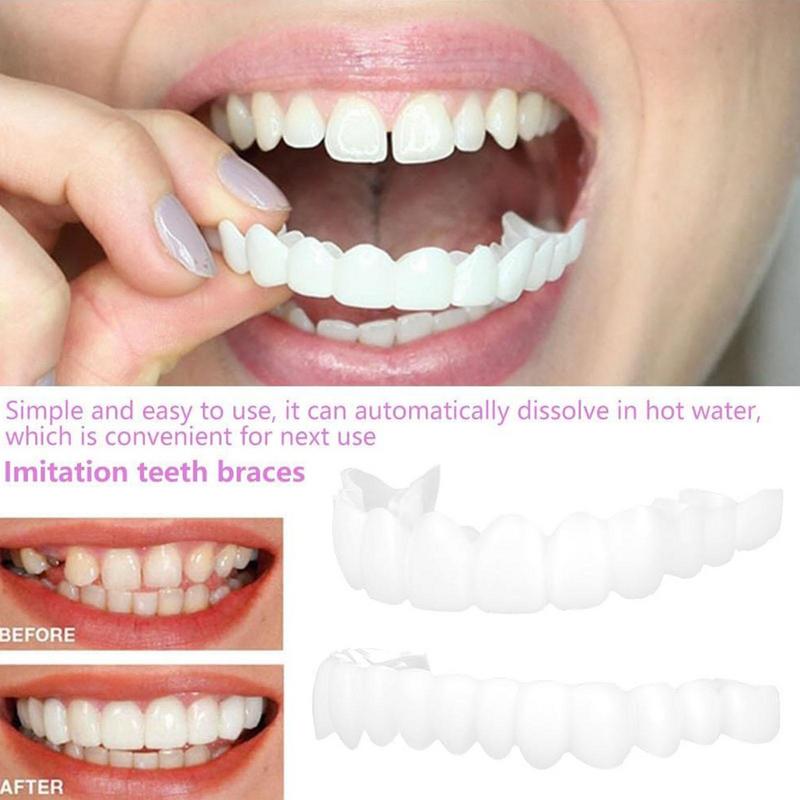 Защелкивающиеся зубы виниры мг – обзор и цена Teeth Whitening Veneers
