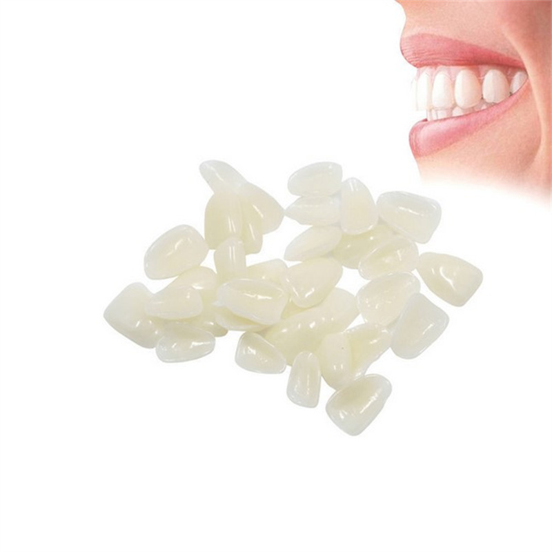 Стоматологические вставные зуб – обзор и цена Teeth Whitening Veneers