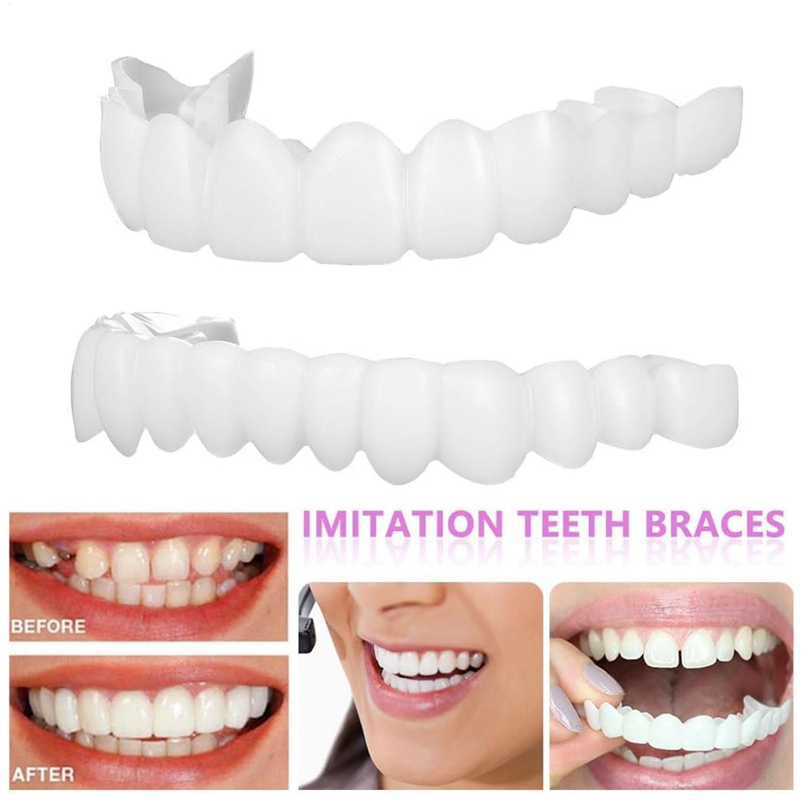 1 пара винипов для зубов, осве – обзор и цена Teeth Whitening Mask