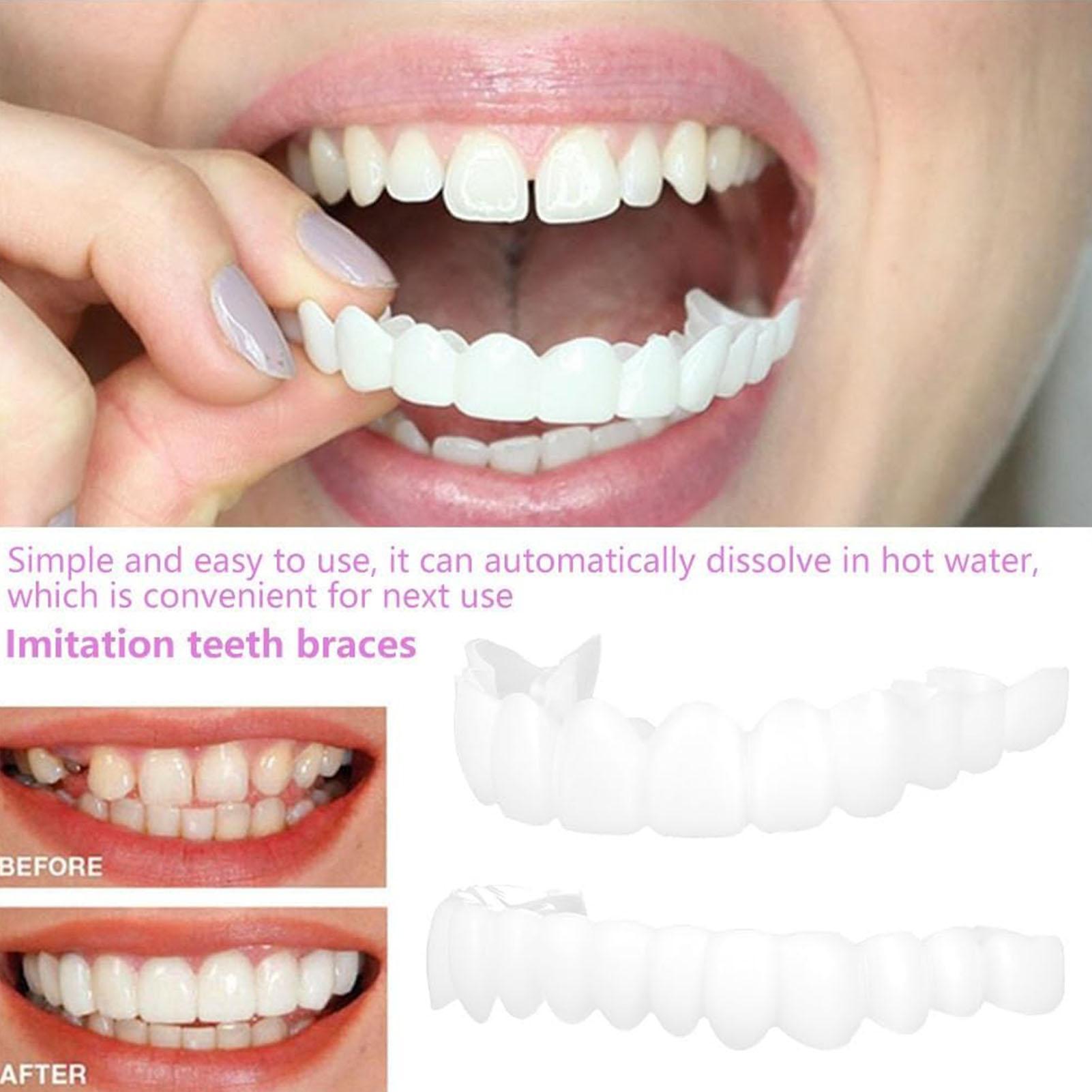 1 пара винипов для зубов, осве – обзор и цена Teeth Whitening Mask