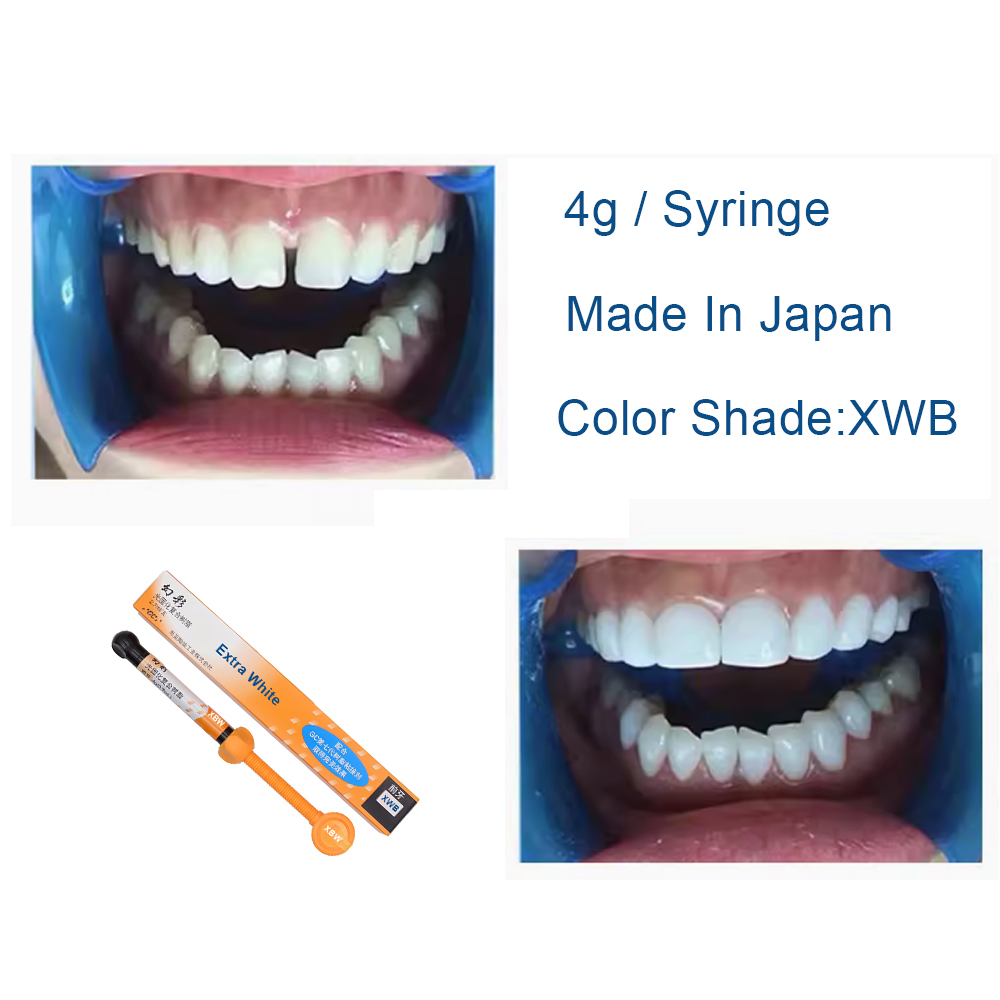 Стоматологическая композитная  – обзор и цена Teeth Whitening Veneers